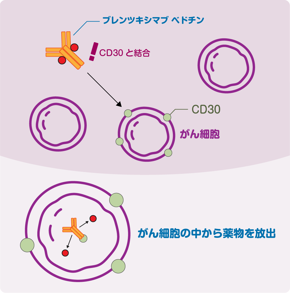 ブラキシズムの臨床 : その発生要因と臨床的対応 JCOG1404 Lay Summary | 日本臨床腫瘍研究グループ（JCOG:Japan
