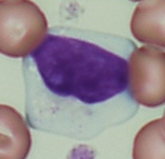 写真　リンパ球